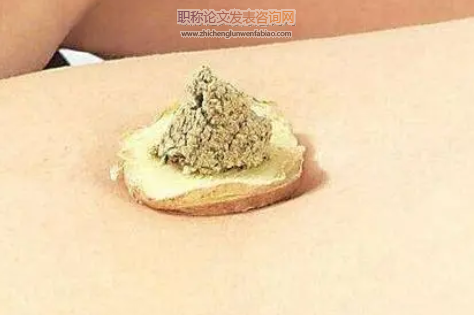 加味小建中湯聯合神闕灸治療小兒脾虛泄瀉臨床